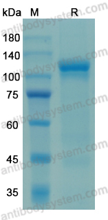 Recombinant Human MGAM/MGA Protein, C-His