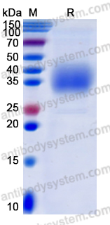 Recombinant Human CD16b/FCGR3B Protein, C-His