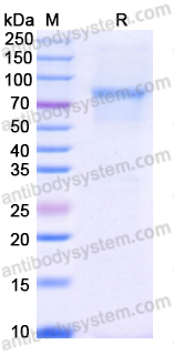 Recombinant Human LGR5/GPR49 Protein, C-His