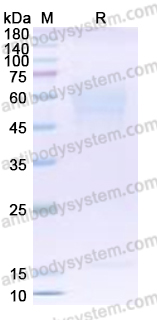 Recombinant Human CD358/TNFRSF21 Protein, C-His