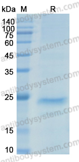 Recombinant Human SLIT2 Protein, C-His
