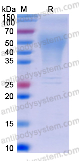 Recombinant Human LYPD3 Protein, C-His