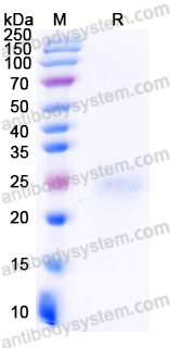 Recombinant Human CD160 Protein, C-His