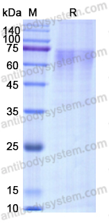 Recombinant Human F9/Factor IX Protein, C-His