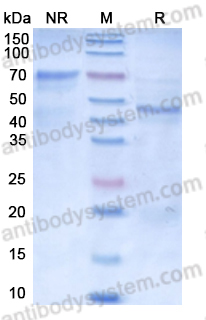 Recombinant Human F10/Factor X Protein, C-His