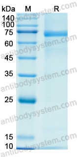 Recombinant Human PLG/Plasminogen Protein, C-His