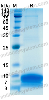 Recombinant Human EGF Protein, C-His