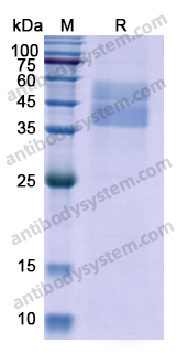 Recombinant Human TGFB1/TGF-beta-1 Protein, C-His