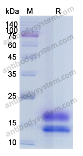 Recombinant Human PCT/Procalcitonin Protein, C-His