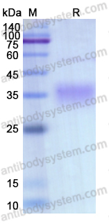 Recombinant Human EPO Protein, C-His