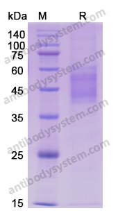 Recombinant Human CD25/IL2RA Protein, C-His