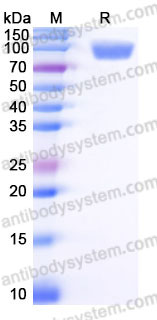 SDS-PAGE for Recombinant Human PIGR Protein, C-His ?>
