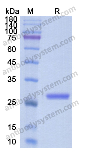 Recombinant Human APCS Protein, C-His