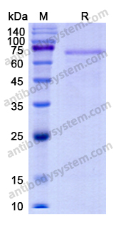 Recombinant Human F11 Protein, C-His