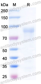 Recombinant Human KLKB1 Protein, C-His