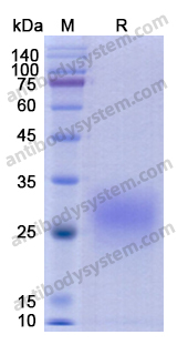 Recombinant Human CD74 Protein, C-His