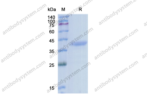 Recombinant Human IGF1 Protein, C-Fc