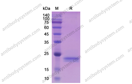 Recombinant Human IL6 Protein, C-His