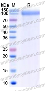 Recombinant Human CD29/ITGB1 Protein, C-His