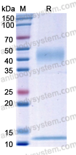 Recombinant Human CD1a & B2M Protein, C-His