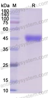 Recombinant Human CD5 Protein, C-His