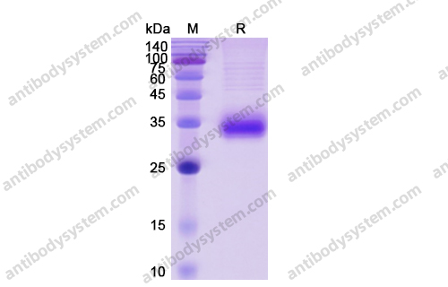 Recombinant Human CD2 Protein, C-His