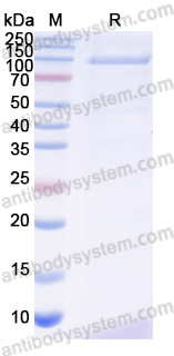 Recombinant Human TPO Protein, C-His