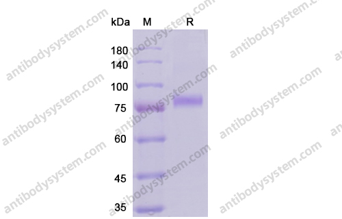 Recombinant Human CD141/THBD Protein, C-His