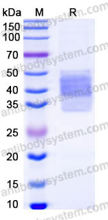 Recombinant Human ASGR1 Protein, C-His