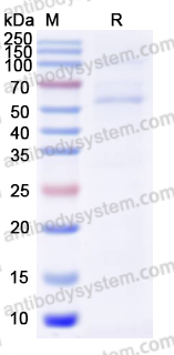 Recombinant Human CD42b/GP1BA Protein, C-His
