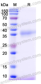 Recombinant Human CD42b/GP1BA Protein, C-His