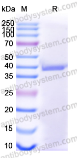 Recombinant Human CTSL Protein, C-His