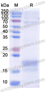 Recombinant Human CD3E Protein, C-His