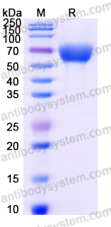 SDS-PAGE for Recombinant Human SERPINA6 Protein, C-His ?>