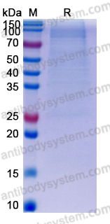 Recombinant Human CD10/MME Protein, C-His