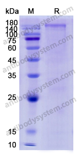 Recombinant Human CD45/PTPRC Protein, C-His