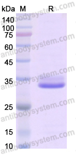 Recombinant Human IGFBP1 Protein, C-His