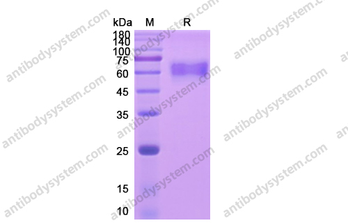 Recombinant Human CD126/IL6R/IL-6RA Protein, C-His