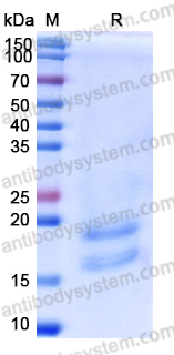 Recombinant Human CD63 Protein, C-His