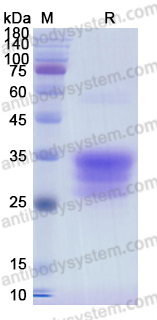 Recombinant Human CD7 Protein, C-His