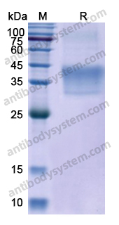 Recombinant Human CSF1/M-CSF Protein, N-His