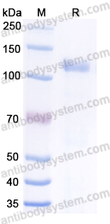 Recombinant Human GAA/Aglucosidase alfa Protein, No tag