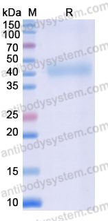 Recombinant Human TFPI Protein, C-His