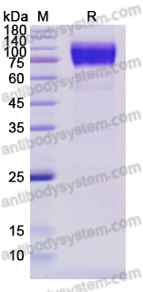 Recombinant Human CD117/KIT Protein, C-His