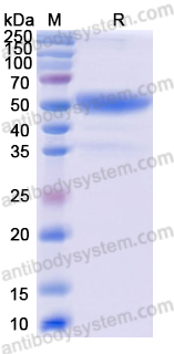 Recombinant Human CD8B Protein, C-Fc