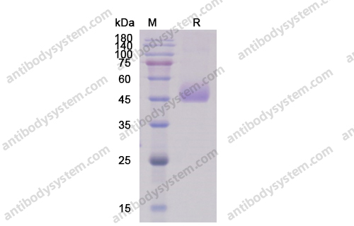 Recombinant Human CD331/FGFR1 Protein, C-His