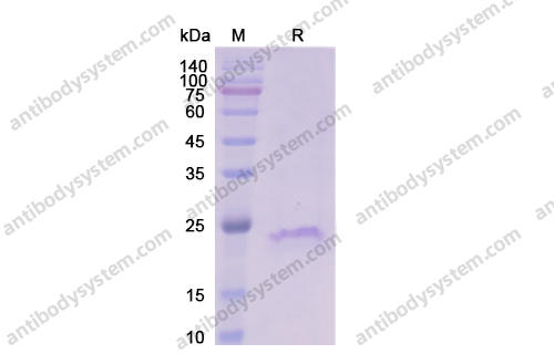 Recombinant Human CD20/MS4A1 Protein, N-His