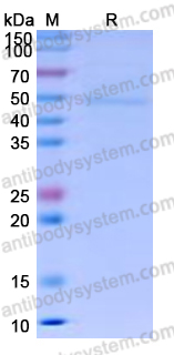 Recombinant Human CD64/FCGR1A Protein, C-His