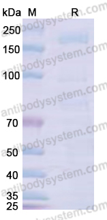 Recombinant Human CD143/ACE Protein, C-His