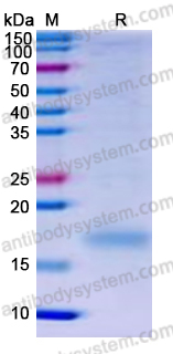 Recombinant Human CD42c/GP1BB Protein, C-His